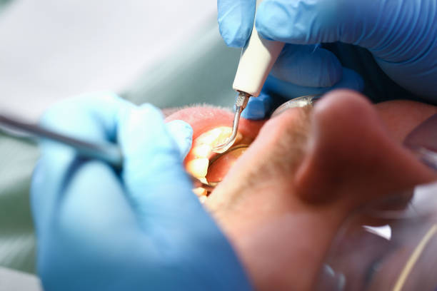 Best Teeth Whitening  in Bellwood, VA
